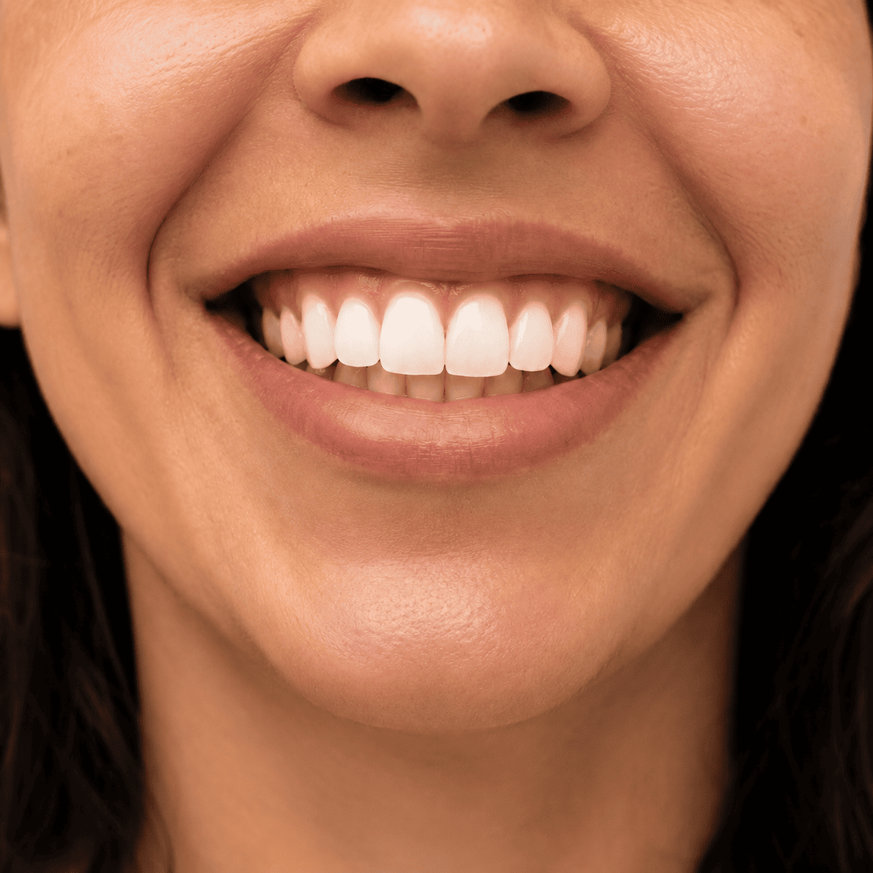 O mesmo sorriso ap&oacute;s escova&ccedil;&atilde;o demonstrativa de dois minutos